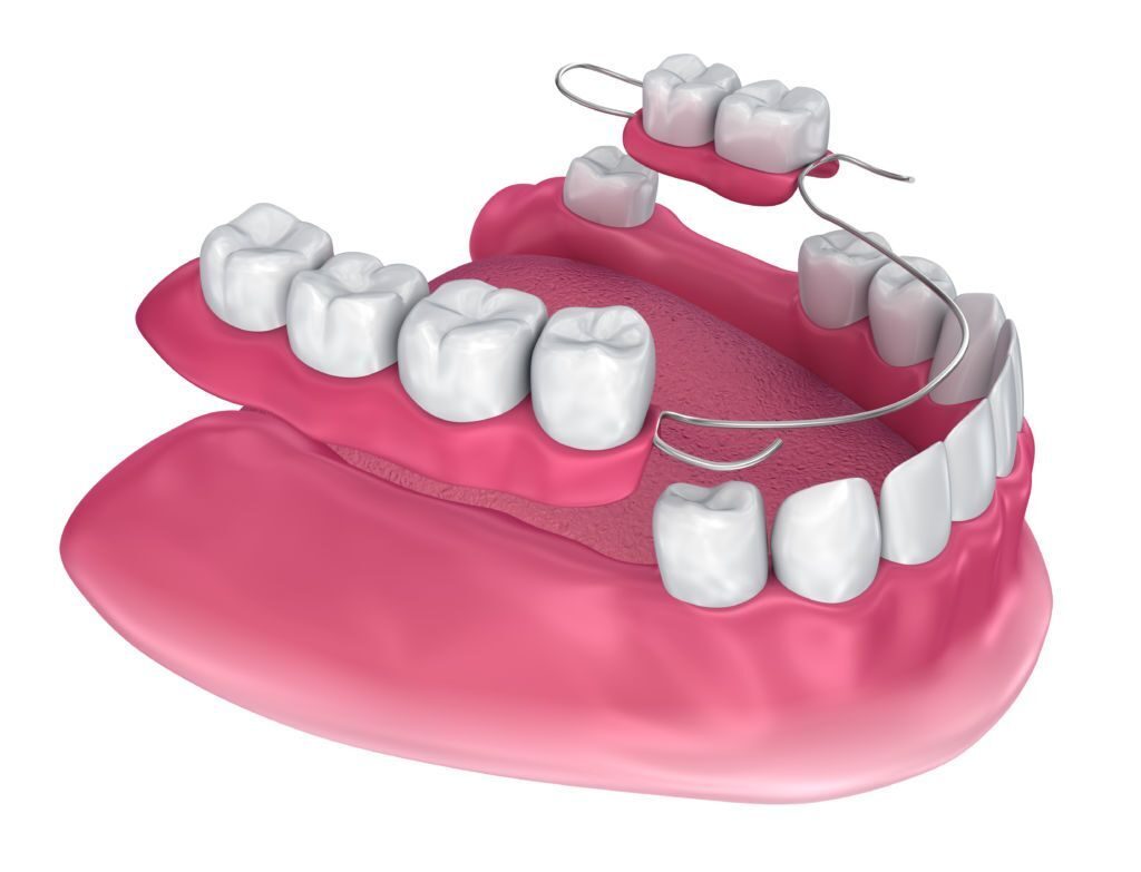 Ортопедический зубной протез